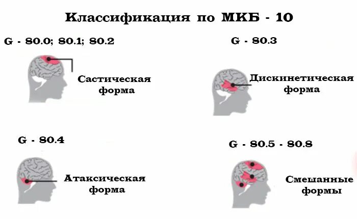 Гемипарез мкб 10. Дцп мкб 10 у детей. классификация дцп мкб 10. клинические проявления дцп. мкб 10 дцп спастический тетрапарез.