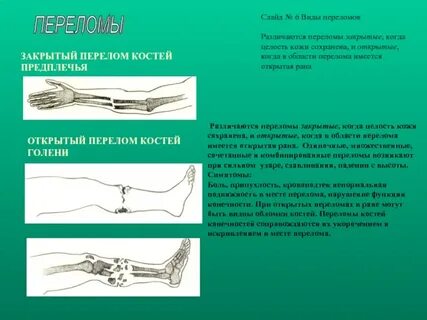Перелом в жизни человека
