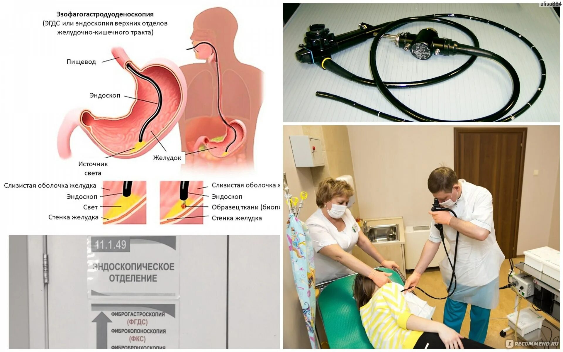 Эгдс и фгдс в чем разница что. Гастроскопия. Гастроскопия желудка. Аппарат ФГДС.