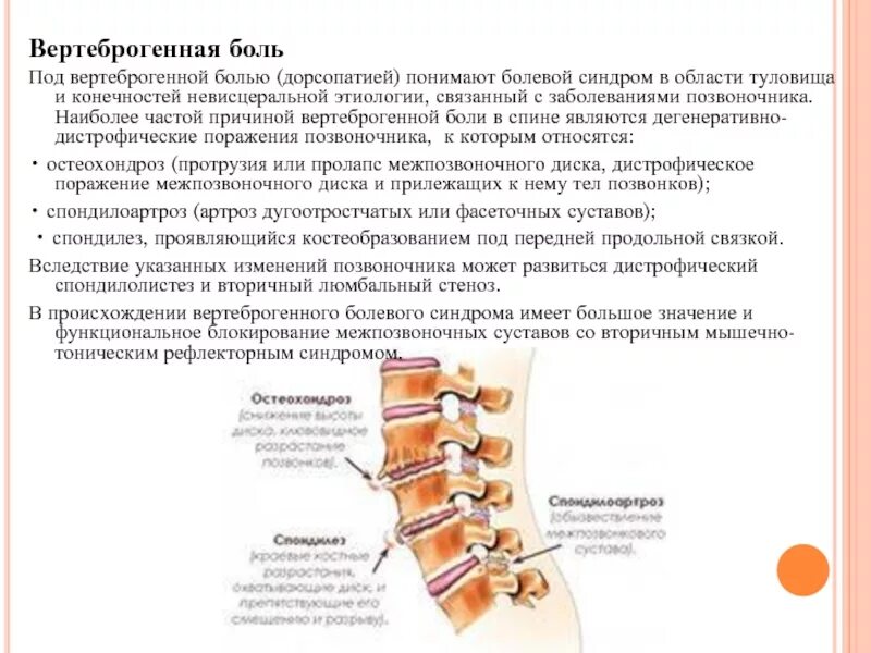 Торакалгия что это за диагноз лечение. Вертеброгенная люмбоишиалгия болевой синдром. Дорсопатии шейного отдела позвоночника. Вертеброгенный болевой синдром характеризуется болью в. Вертеброгенная боль в спине.