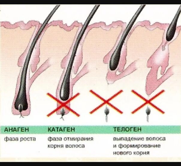 Растут корни волос. Этапы роста волос. Выдергивание волоса с луковицей. Цикл роста волос. Для роста волос.