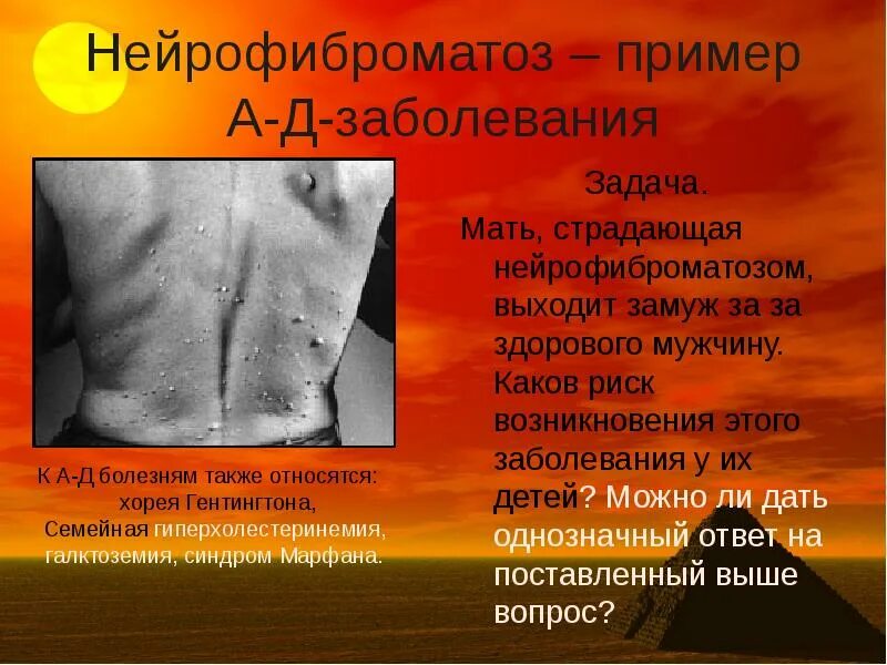 Проявление нейрофиброматоза