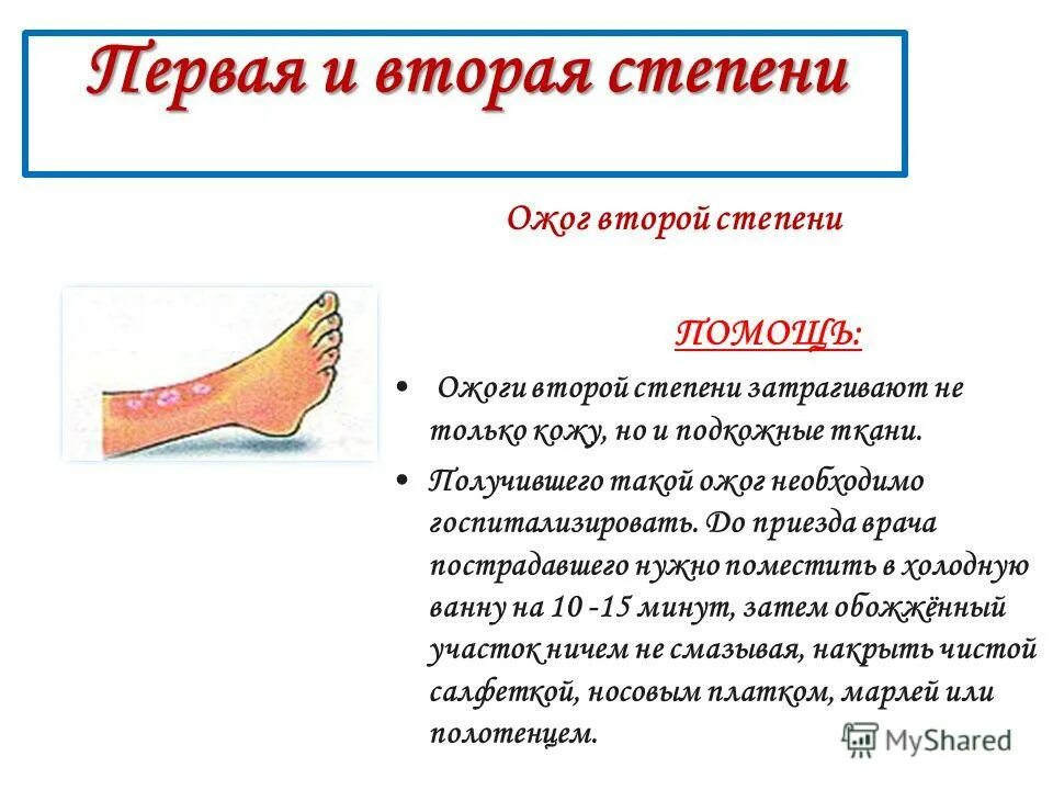 Установите соответствие степени ожога