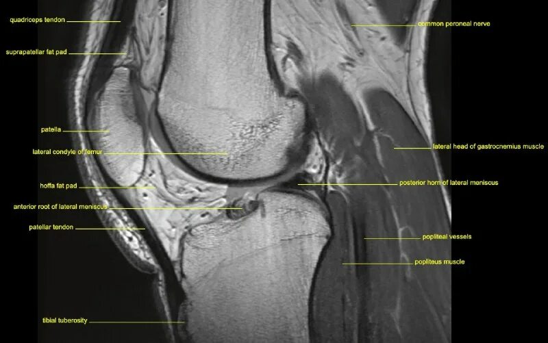 Мрт электросталь горького 12. Мрт мой снимок. Мрт открытого типа в казани. Мрт суставов могилев. Мрт в симферополе 7 горбольница.