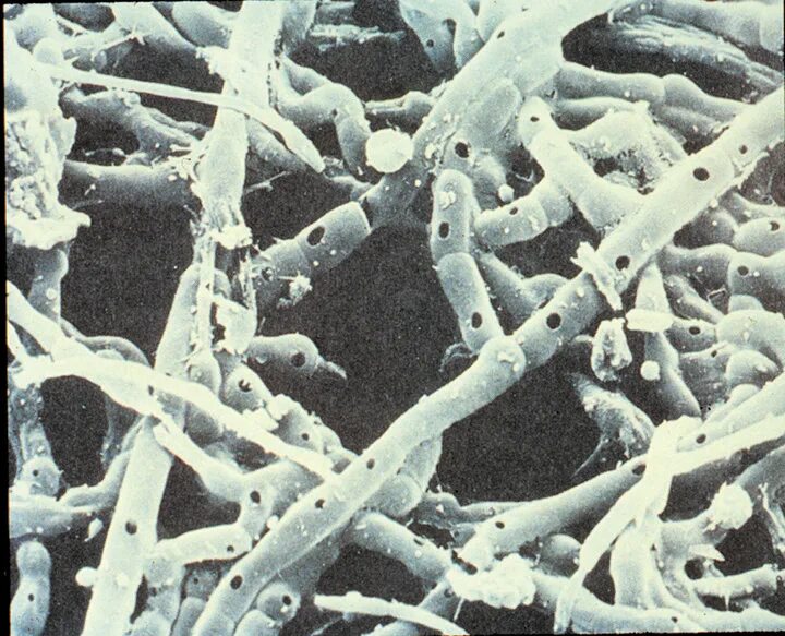 Разрушающие микроорганизмы. Дикариотический мицелий. Мицелий грибов под микроскопом. Ризоктония мицелий. Мицелий грибов микробиология.