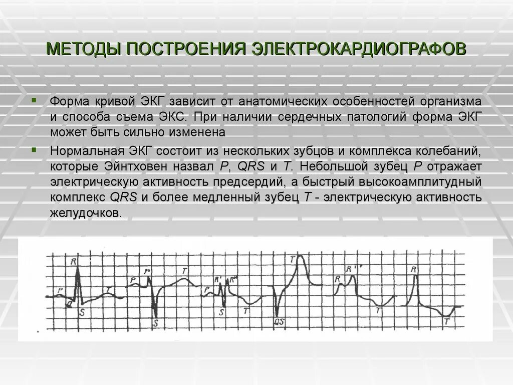 Форма Кривой ЭКГ. Монофазная кривая на ЭКГ. Электрокардиография кривая. Бланк ЭКГ.