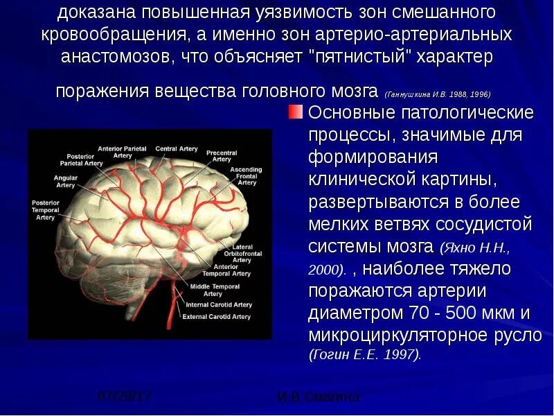 Многоочаговое поражение мозга. Процессы головного мозга. Объемные процессы головного мозга. Патологические процессы в головном мозге. Исключение объемного процесса головного мозга это что.