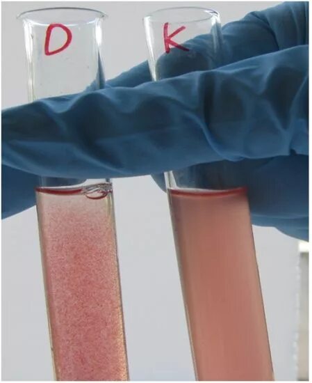 резус совместимость в пробирке. таблица определения группы крови и резус фактора. определение резус принадлежности крови экспресс методом. пробирки с кровью. резус совместимость в пробирке.