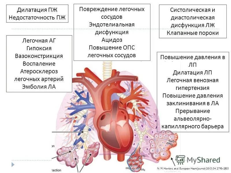 Легочно-сердечная недостаточность. ХСН систолическая и диастолическая. Хроническая сердечно легочная недостаточность. Легочное сосудистое сопротивление.