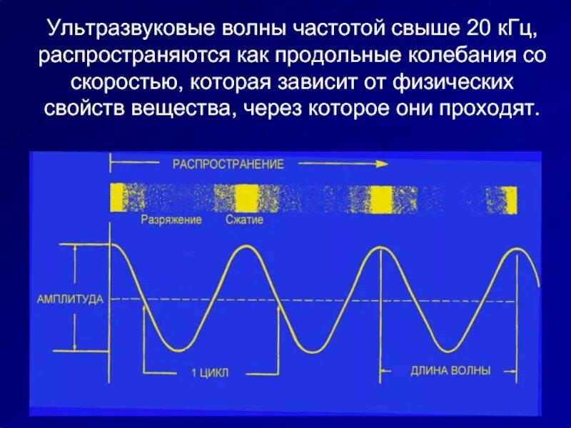 Какой вид волн имеет наименьшую длину. Ультразвуковые колебания длины волн и частоты. Ультразвуковые волны физика свойства. Ультразвуковые волны частота.