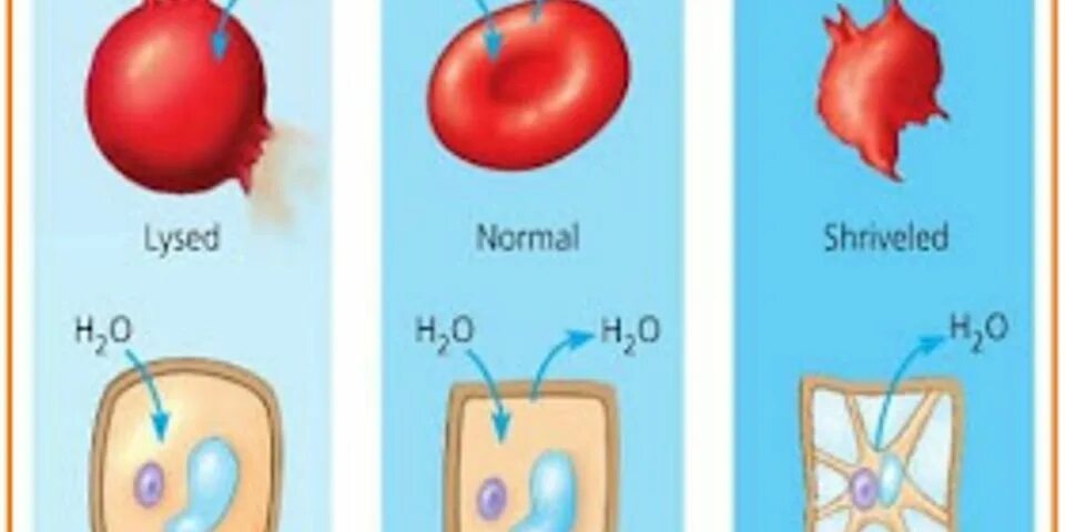Эритроциты в гипотоническом растворе. Гипертонический осмос эритроцитов. Клетка в гипертоническом растворе. Изотонический и гипертонический раствор и эритроцит. Клетку поместили в дистиллированную воду