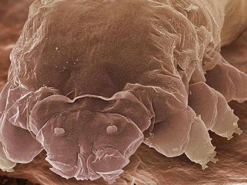 Ресничные клещи демодекс. Клещ Железница (Demodex folliculorum). Клещ демодекс под микроскопом. Ресничный клещ Demodex folliculorum