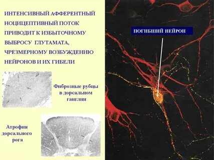 Отмирание клеток мозга
