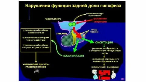 Нарушение функций гипофиза
