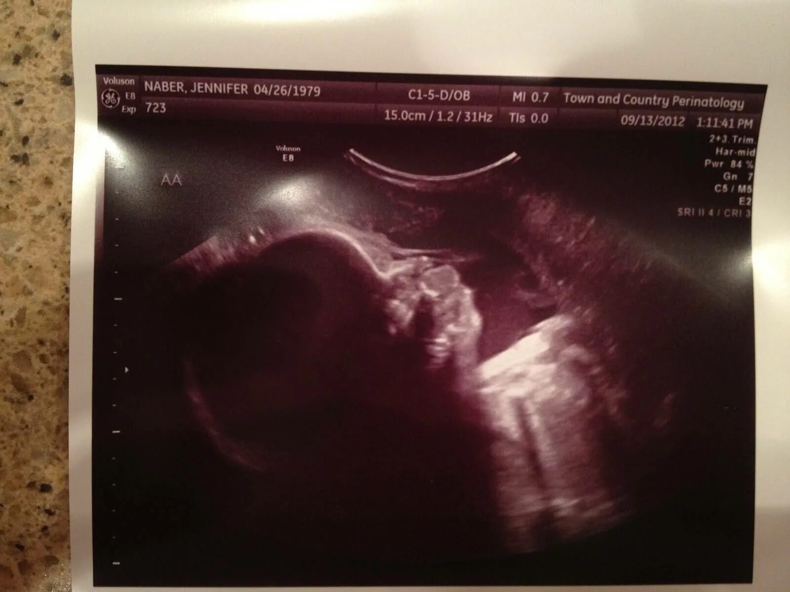 33 неделя размеры. Эмбрион 33 недели беременности. УЗИ 33 недели беременности.