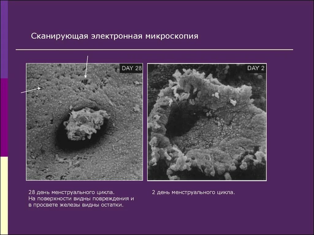 Выберите изображения полученные методом сканирующей электронной микроскопии. Сканирующая электронная микроскопия. растровая электронная микроскопия. метод сканирующей (растровой) электронной микроскопии. принципиальная схема сканирующего электронного микроскопа.