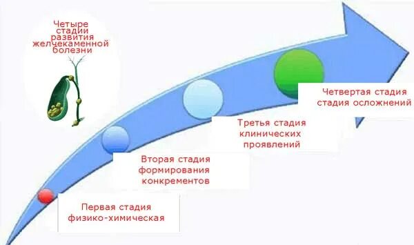 4 этапа рождения. Фазы желчекаменной болезни. Четыре стадии. Этапы рождения. Четыре стадии смерти.