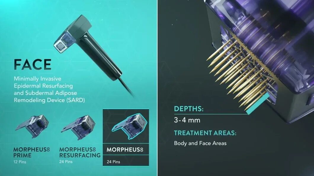 Микроигольчатый лифтинг morpheus. Как работает насадка morpheus 8.