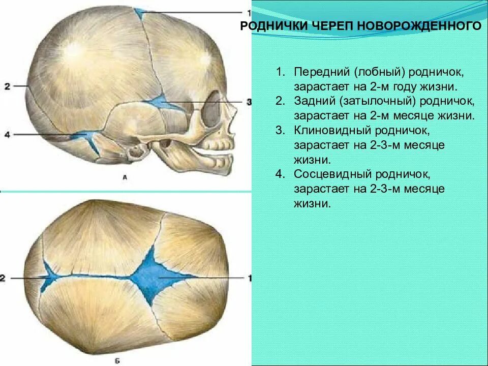 Соединение между лобной и теменной костями. Роднички черепа новорожденного. Роднички черепа новорождённого . Клиновидный и сосцевидный. Передний Родничок черепа новорожденного. Роднички черепа зарастают к.