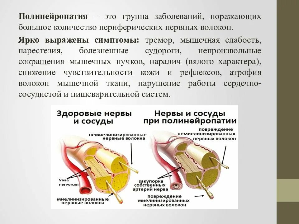 Полинейропатия конечностей причины. Полинейропатия. Симптомы полинейропатии. Полинейропатии неврология. Диабетическая полинейропатия, алкогольная полинейропатия..