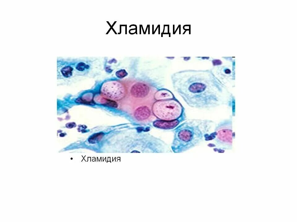 Хламидии микробиология. Хламидии урогенитального хламидиоза. Хламидии препарат микробиология.