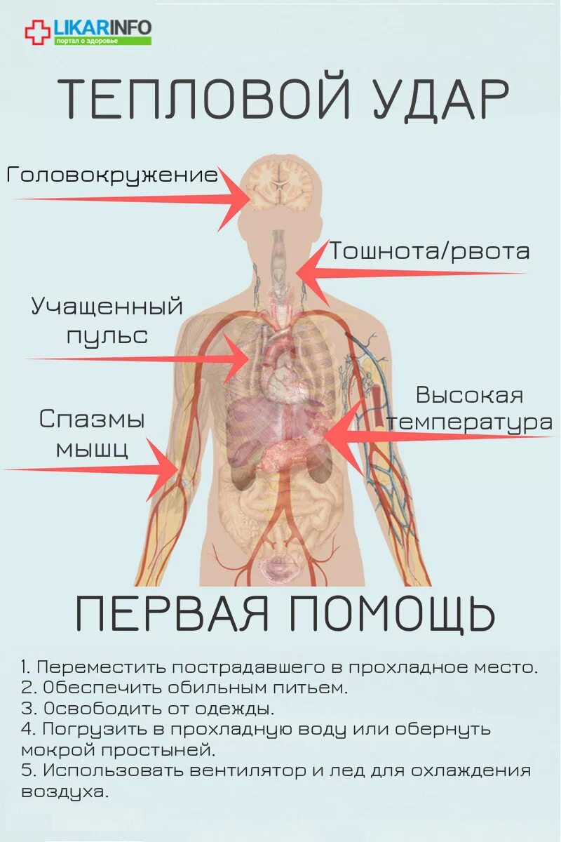 Солнечный приступ. Сердечный приступ. Отравление лекарствами. Тепловой удар и солнечный удар первая помощь. Солнечный удар.
