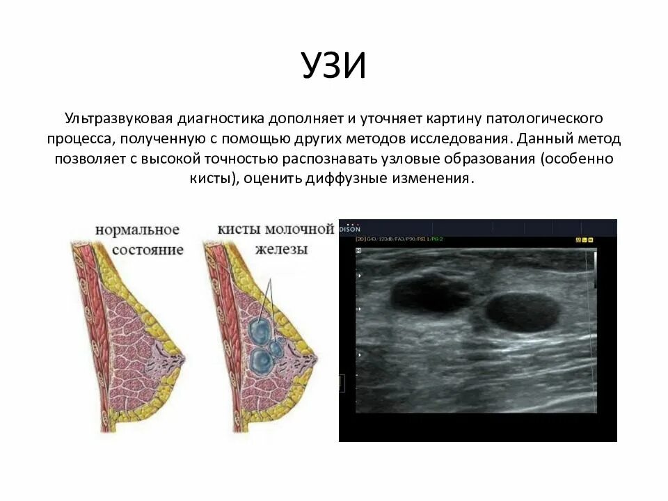 Доброкачественные заболевания молочных желез классификация. Воспалительные заболевания молочных желез. Правоустанавливающие и правоудостоверяющие документы. Пред ракммолочной железы. Заболевания молочных желез.