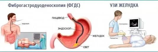 Водно сифонная проба желудка. Язвенная болезнь желудка ФГДС. Язвенная болезнь ДПК ФГДС. Двенадцатиперстная кишка ФГДС.