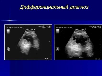 Очаговое образование