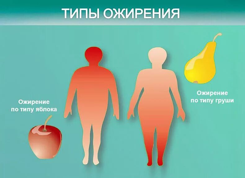 Абдоминальный и гиноидный Тип ожирения. Типы ожирения гиноидное и андроидное. Типы ожирения гиноидное. Периферический Тип ожирения.