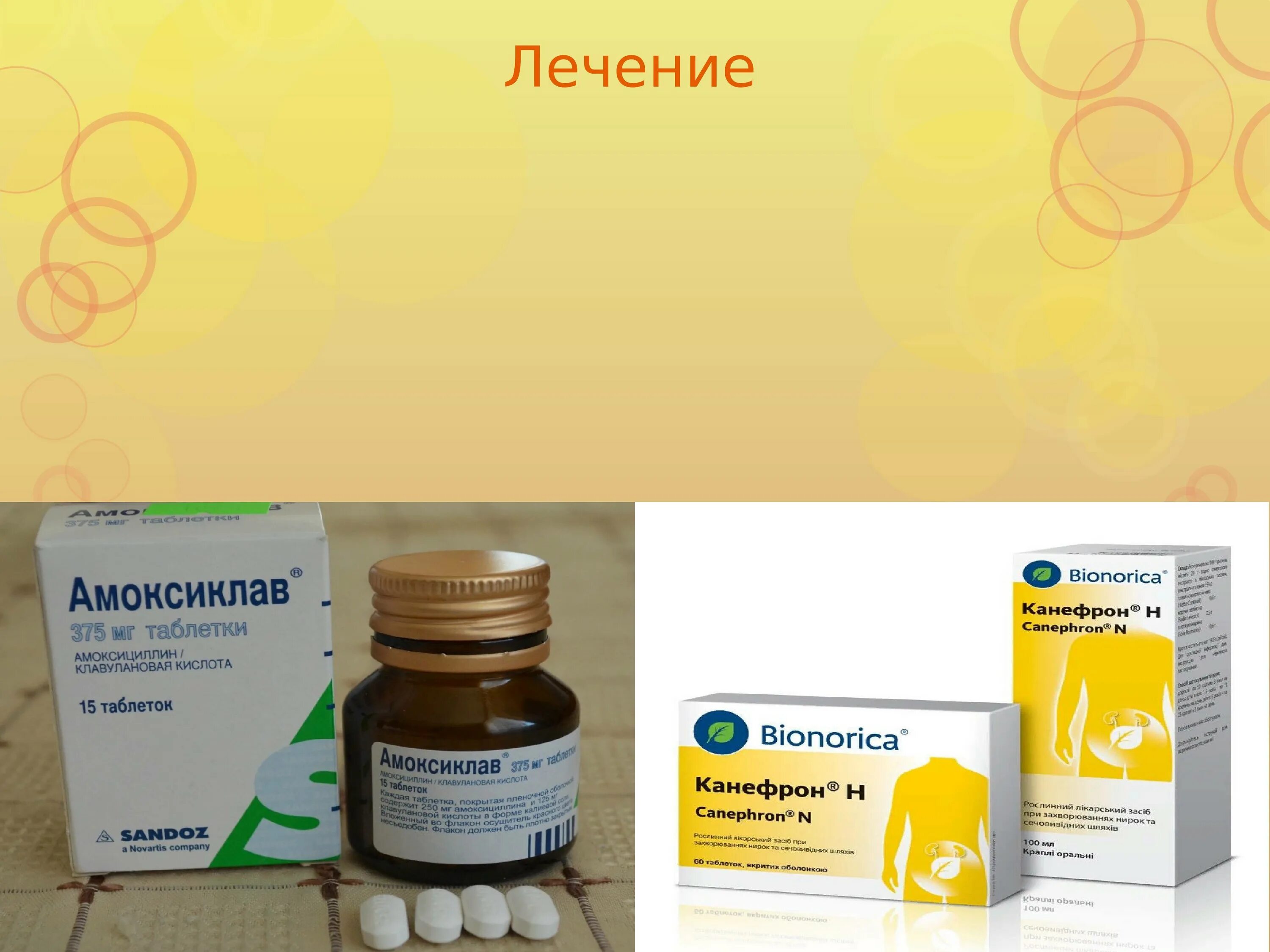 Какое лечение от цистита. Лекарство от пиелонефрита и цистита. препараты от цистита для детей. таблетки от цистита и пиелонефрита у женщин. таблетки от пиелонефрита и цистита.