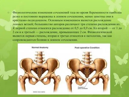 Болит таз при беременности