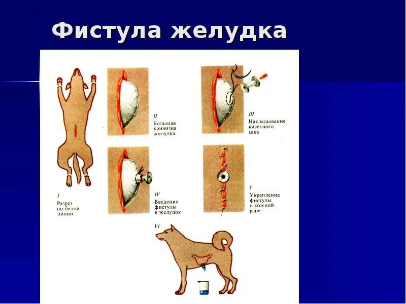 Фистула что это такое простыми. Фистула что это такое простыми. Фистулы от гемодиализа. Фистула гемодиализ схема предплечье. Фистула что это такое простыми.
