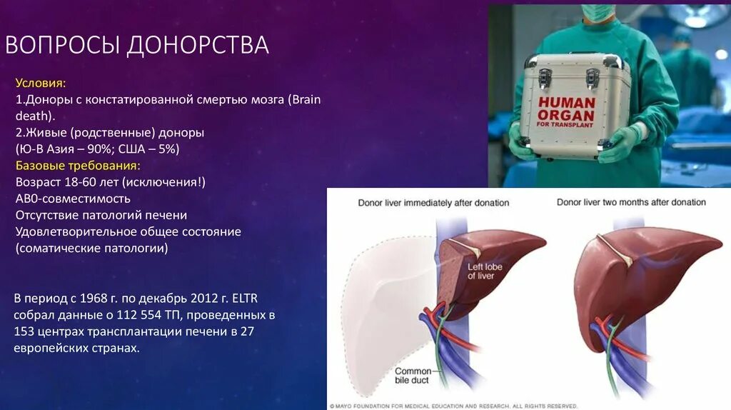 Пересадка печени стоимость. Трансплантация печени. Ортотопическая трансплантация печени. Трансплантация печени от живого донора.