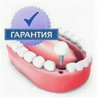 Гарантия на зубы после лечения