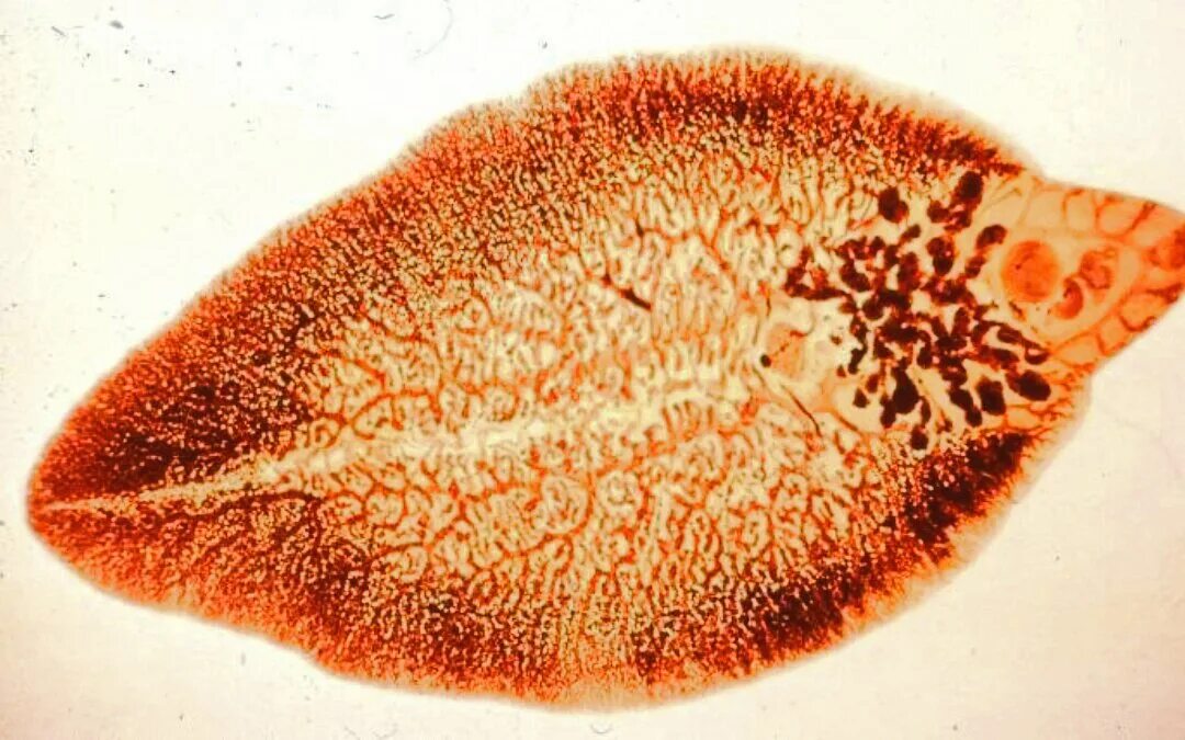 Печеночный сосальщик. Печеночный сосальщик фасциола. Плоские черви печеночные сосальщики. Плоский червь печеночный сосальщик.