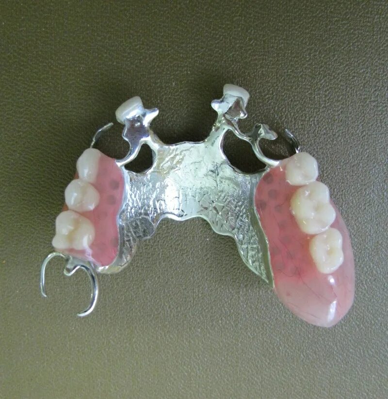 штампованная коронка титан. бюгельный мостовидный протез. литой протез. мостовидный протез моделировка. цельнолитая коронка (кхс с напылением).