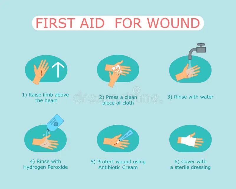 First aid bleeding. First aid bleeding