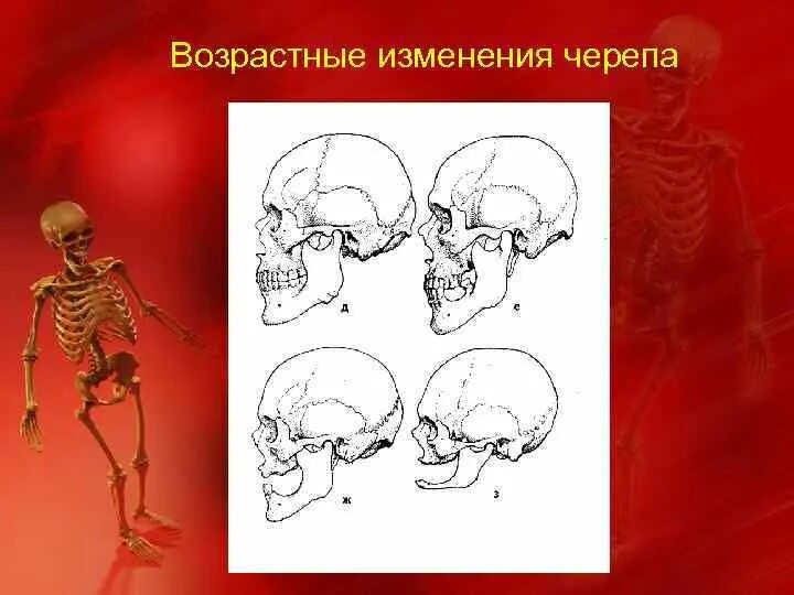 Основным признаком возрастных изменений костей. Возрастныизменения черепа. Возворастные ищменнеия череп. Возрастные изменения черепа. Изменение черепа с возрастом.