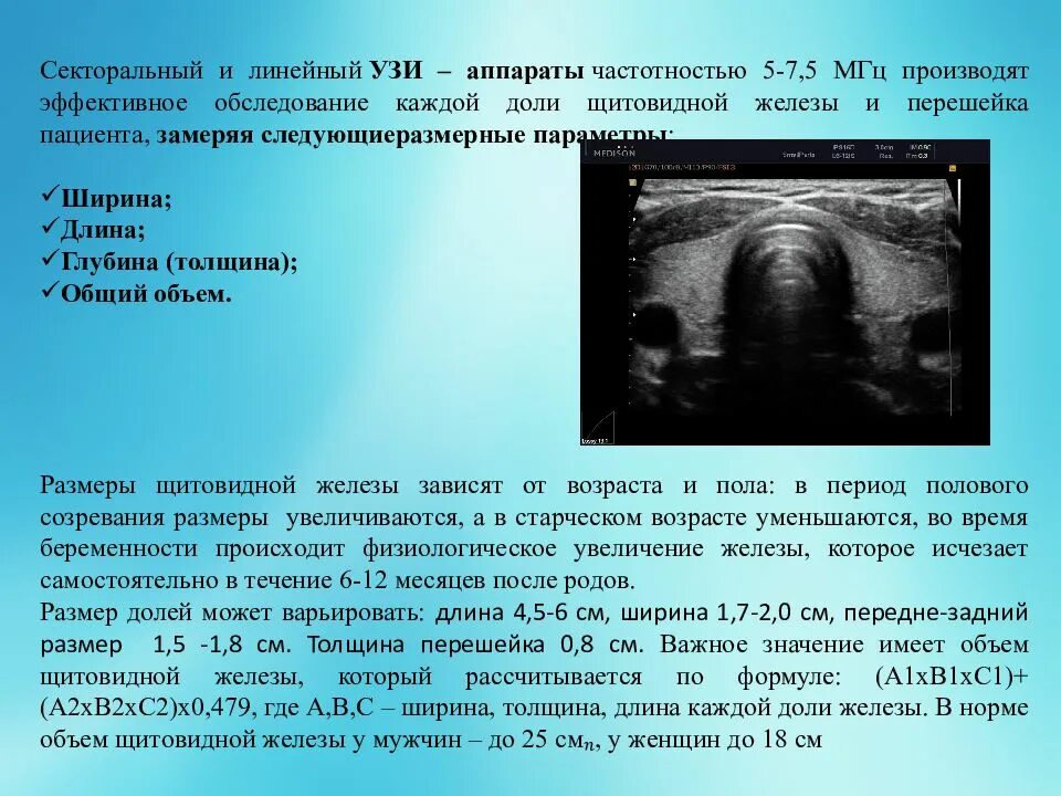 Какие должны быть нормы щитовидной железы. Длина ширина и толщина щитовидной железы на УЗИ. Нормы исследования щитовидной железы УЗИ. Объем щит железы в норме по УЗИ. Объем щитовидной железы УЗИ.