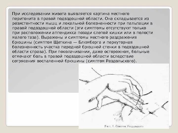 Щеткина блюмберга при аппендиците. Острый аппендицит пальпация. Пальпация червеобразного отростка. Пальпация живота при аппендиците. Пальпация при аппендиците.