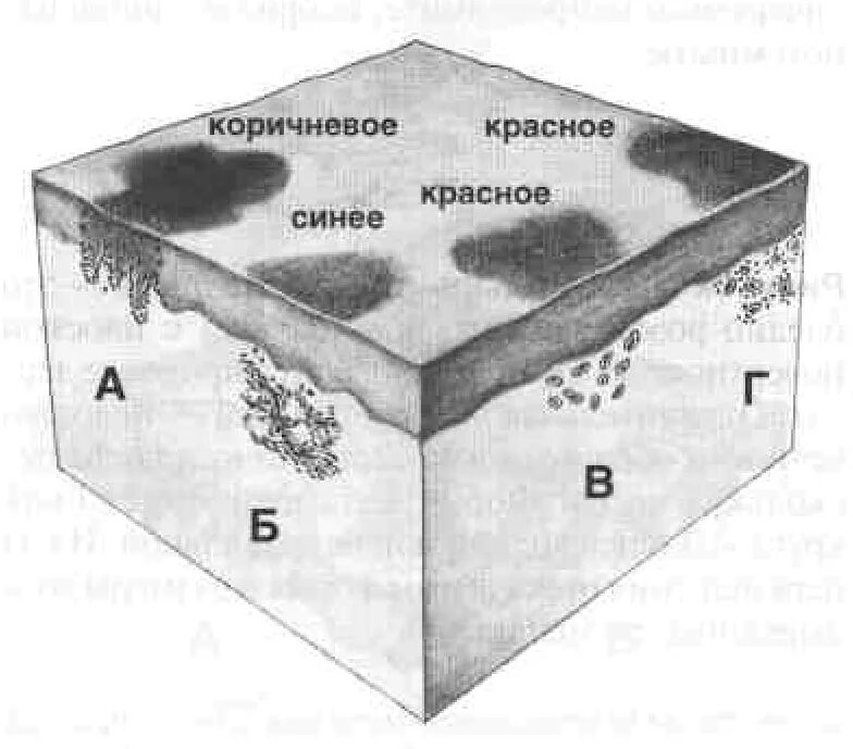 Пятно первичный элемент. Морфологические элементы кожи папула. морфологические элементы сыпи. первичные морфологические элементы.