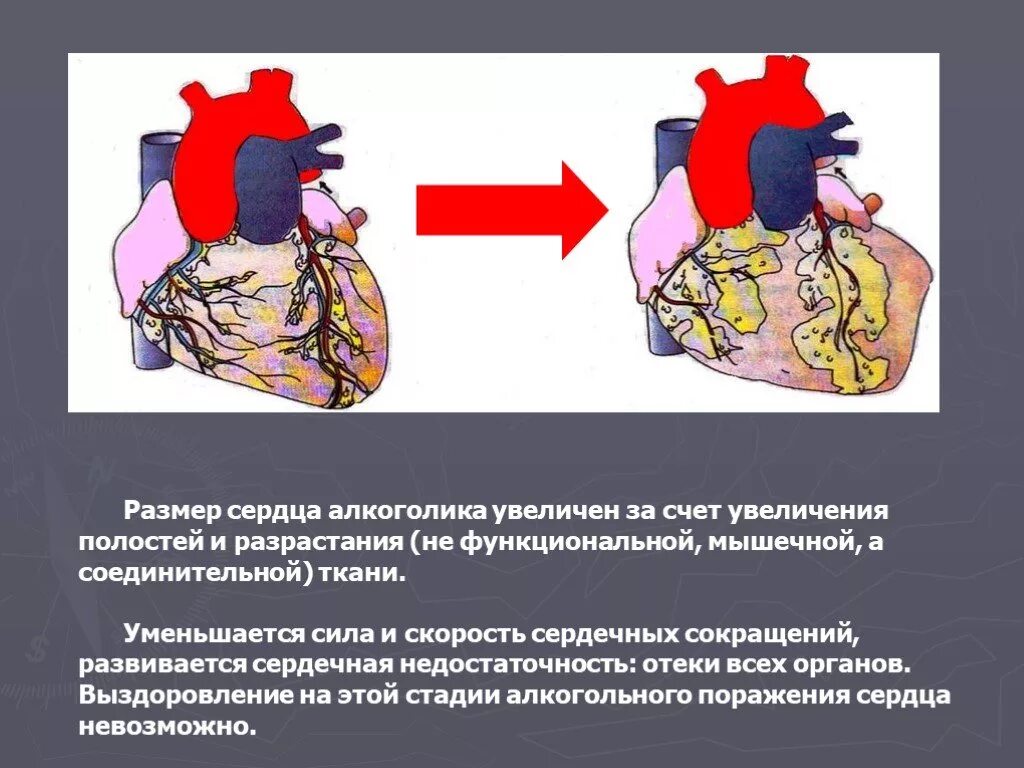Сердце здорового и алкоголика. Сердце здорового человека и алкоголика.