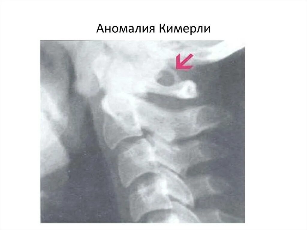 Как лечить аномалию