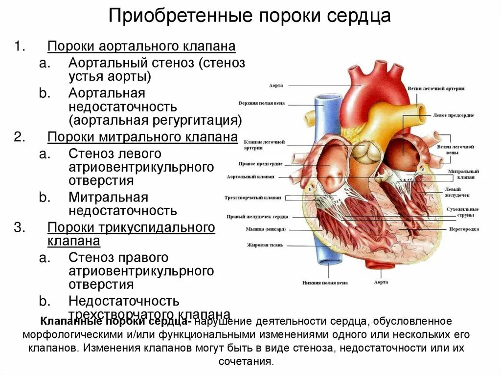 Классификация приобретенных клапанных пороков сердца.. Морфологическая характеристика приобретенных пороков сердца. Разновидности приобретенных пороков сердца. Приобретенные клапанные пороки сердца.