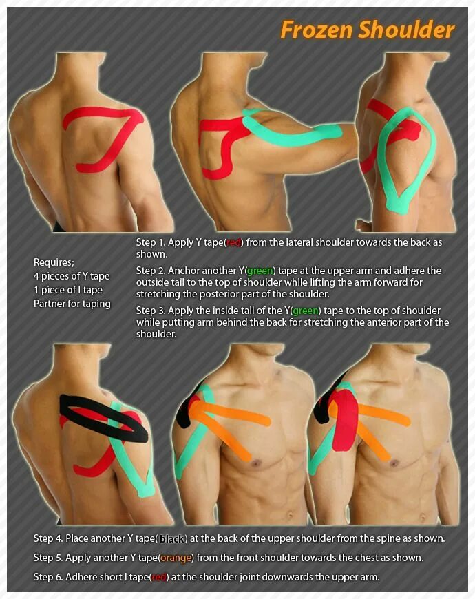 Растяжение связок плечевого сустава тейпирование. Схема фиксации плечевого сустава тейпом. Схема тейпирования связок плечевого сустава. Тейпирирование лопатки и плеча. Через какое плечо нужно