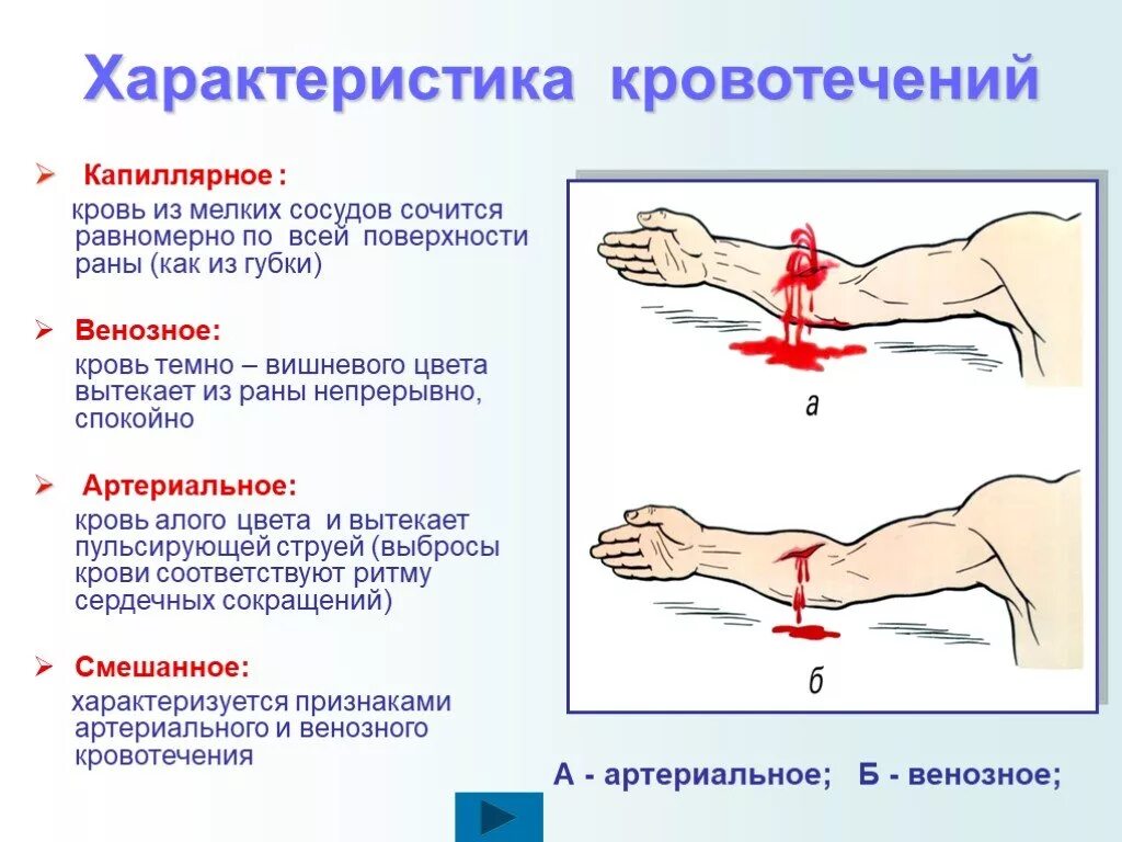 Сколько течет кровь. Особенности капиллярного кровотечения. Характеристика капиллярного кровотечения. Характеристика венозного и артериального кровотечения. Кроврьевение капиллчрное аинощное.