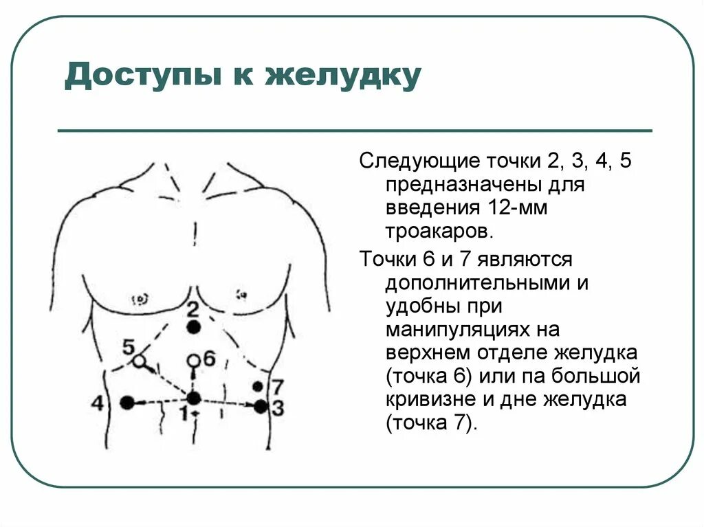 Точки на животе для похудения. Схема акупунктурных точек при гипертонии. Точка лао гун. Точка давний. Точки на шее человека.