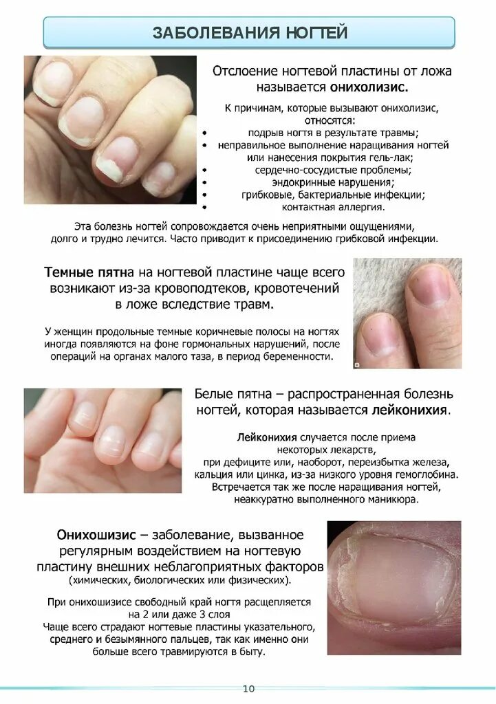 Заболевания ногтей таблица описание и картинки