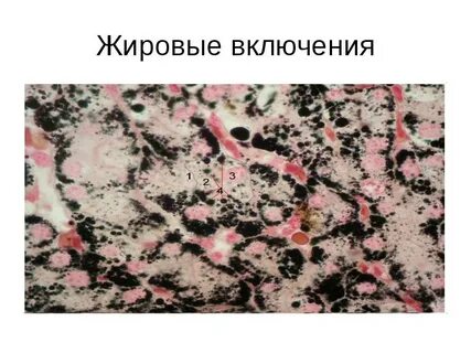 Жировые включения в клетках